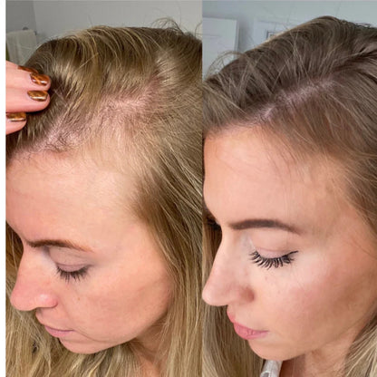 GrowTurn Hair Sérum 100ml