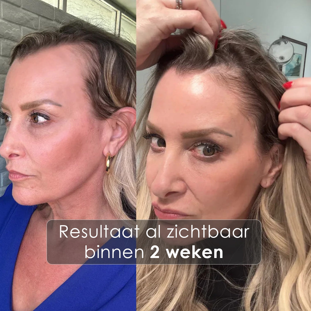 GrowTurn Hair Sérum 100ml