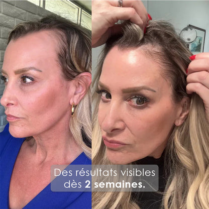 GrowTurn Hair Sérum 100ml